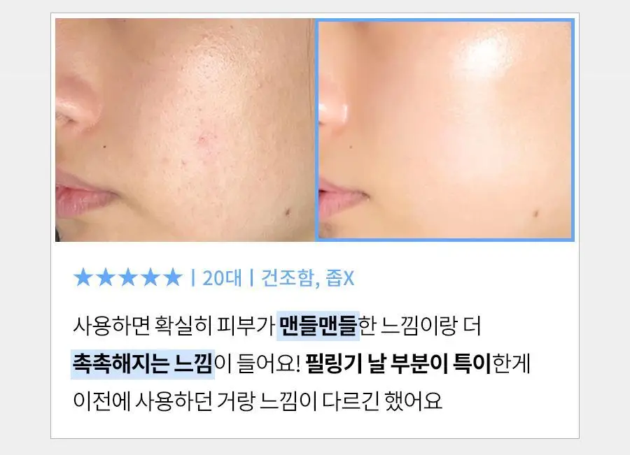 [피지제거/필링] 페이스팩토리 제트 필링기 상세페이지 13